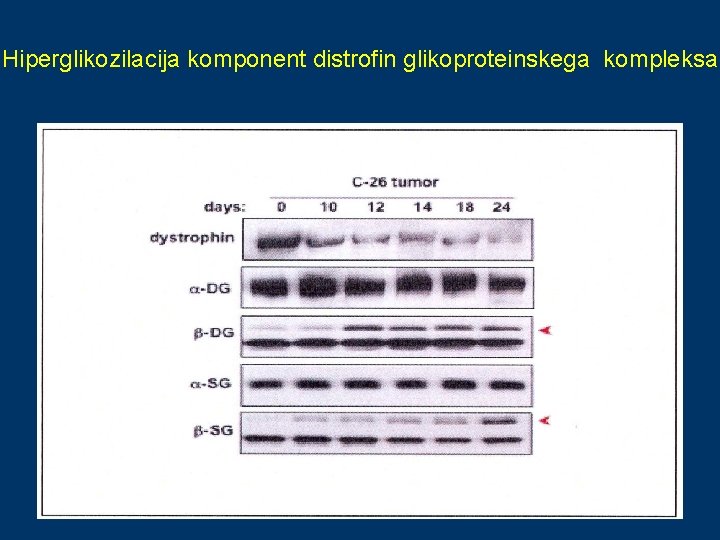 Hiperglikozilacija komponent distrofin glikoproteinskega kompleksa 