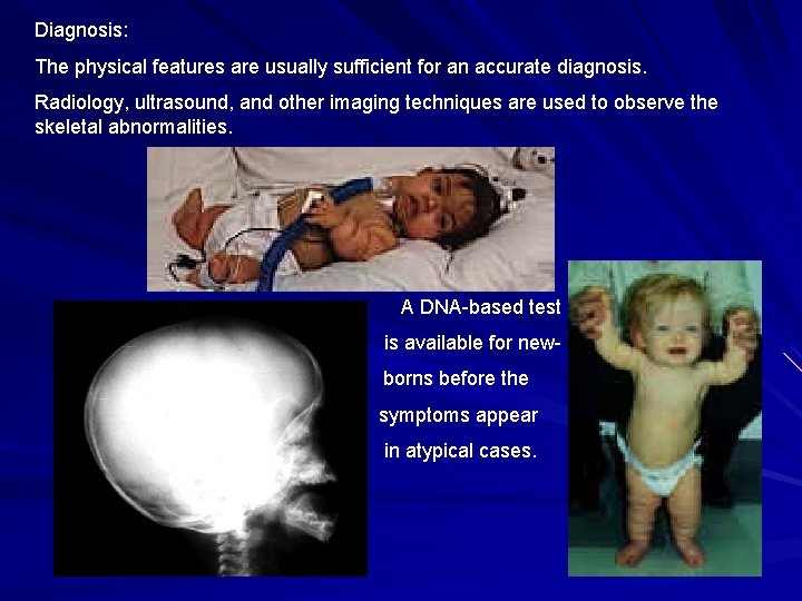Diagnosis: The physical features are usually sufficient for an accurate diagnosis. Radiology, ultrasound, and