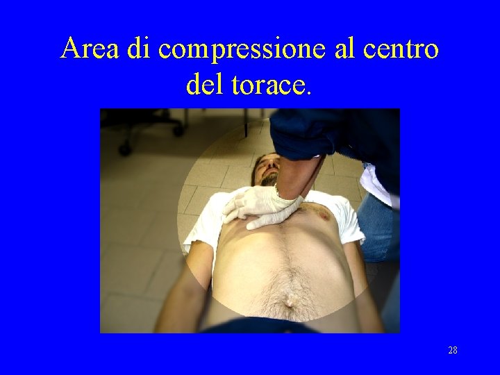 Area di compressione al centro del torace. 28 