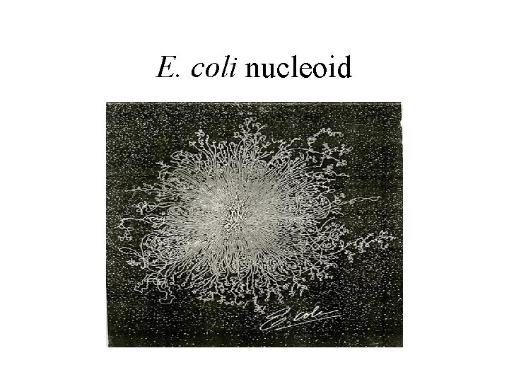 E. coli nucleoid 