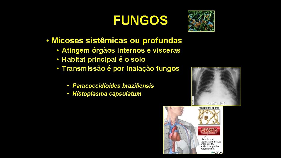 FUNGOS • Micoses sistêmicas ou profundas • Atingem órgãos internos e visceras • Habitat