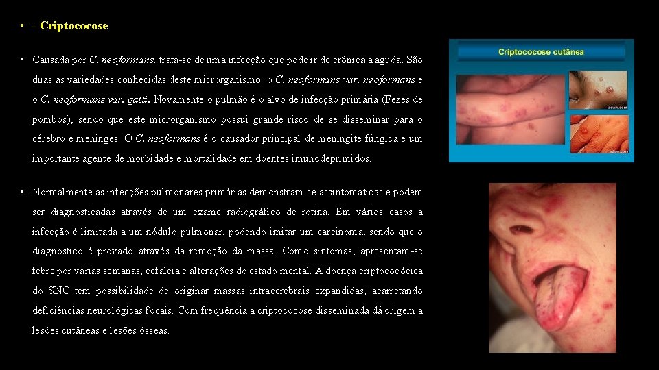  • - Criptococose • Causada por C. neoformans, trata-se de uma infecção que