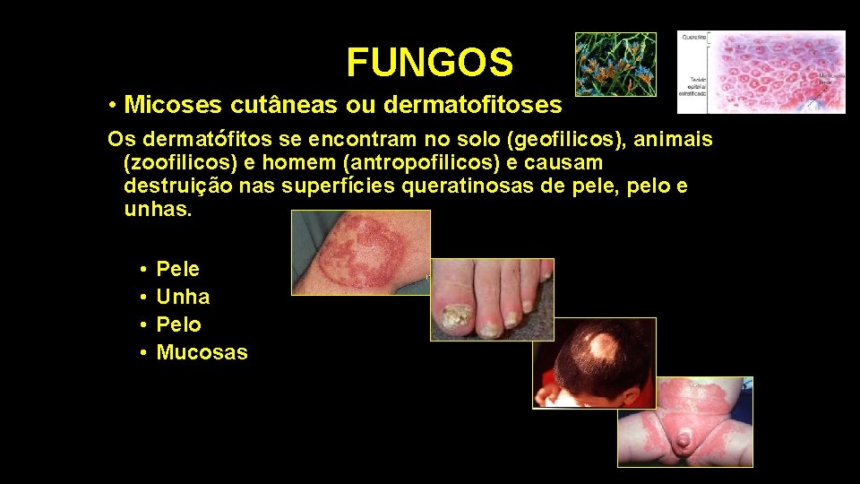 FUNGOS • Micoses cutâneas ou dermatofitoses Os dermatófitos se encontram no solo (geofilicos), animais