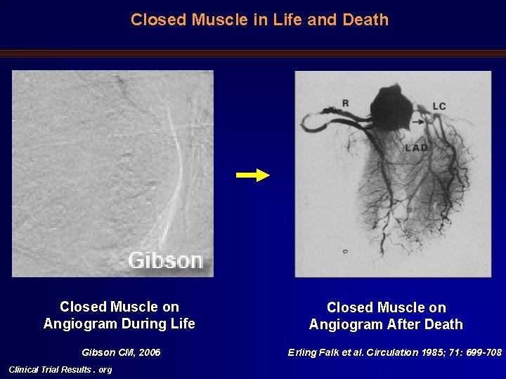 Closed Muscle in Life and Death Closed Muscle on Angiogram During Life Gibson CM,