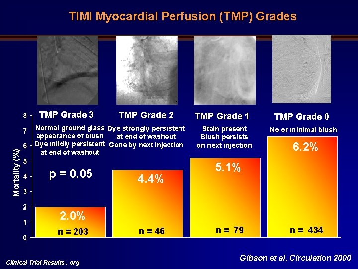 TIMI Myocardial Perfusion (TMP) Grades Mortality (%) TMP Grade 3 TMP Grade 2 Normal