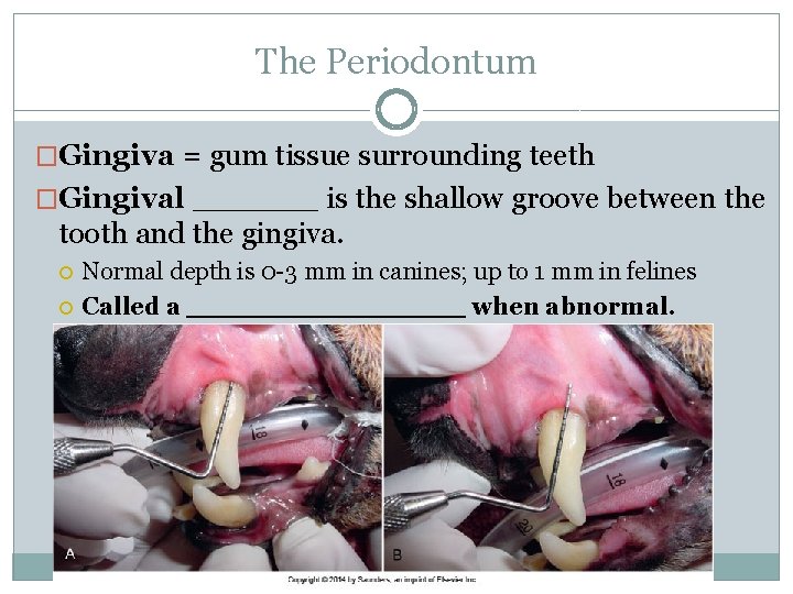 The Periodontum �Gingiva = gum tissue surrounding teeth �Gingival ______ is the shallow groove