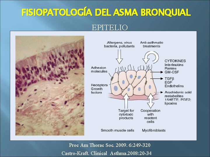 FISIOPATOLOGÍA DEL ASMA BRONQUIAL EPITELIO Proc Am Thorac Soc. 2009. 6: 249 -320 Castro-Kraft.