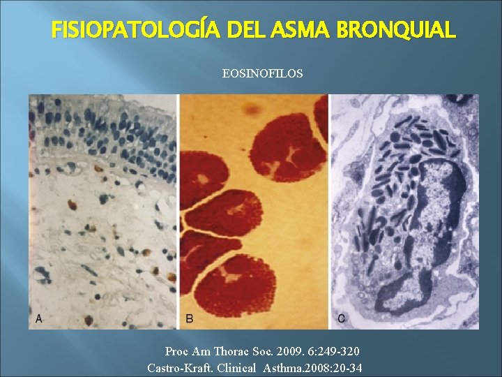FISIOPATOLOGÍA DEL ASMA BRONQUIAL EOSINOFILOS Proc Am Thorac Soc. 2009. 6: 249 -320 Castro-Kraft.