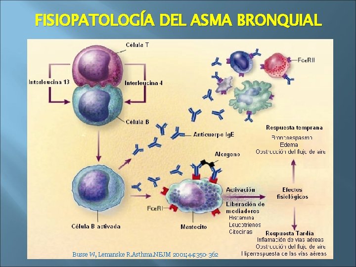 FISIOPATOLOGÍA DEL ASMA BRONQUIAL Busse W, Lemanske R. Asthma. NEJM 2001; 44: 350 -362