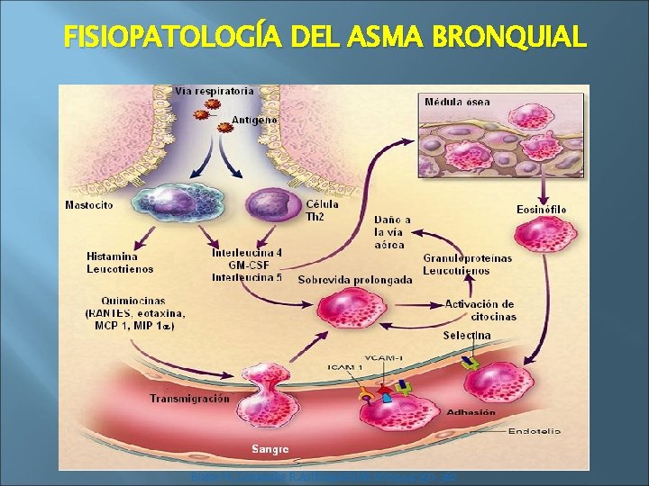 FISIOPATOLOGÍA DEL ASMA BRONQUIAL Busse W, Lemanske R. Asthma. NEJM 2001; 44: 350 -362