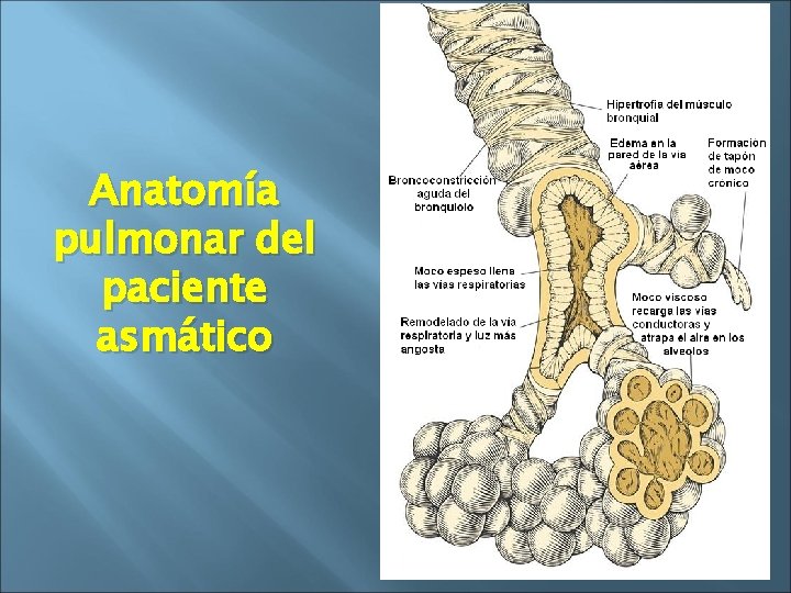 Anatomía pulmonar del paciente asmático 