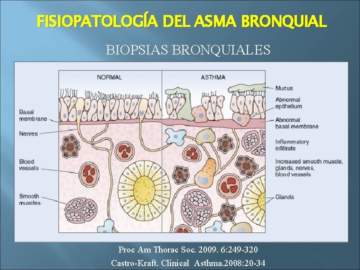 FISIOPATOLOGÍA DEL ASMA BRONQUIAL BIOPSIAS BRONQUIALES Proc Am Thorac Soc. 2009. 6: 249 -320