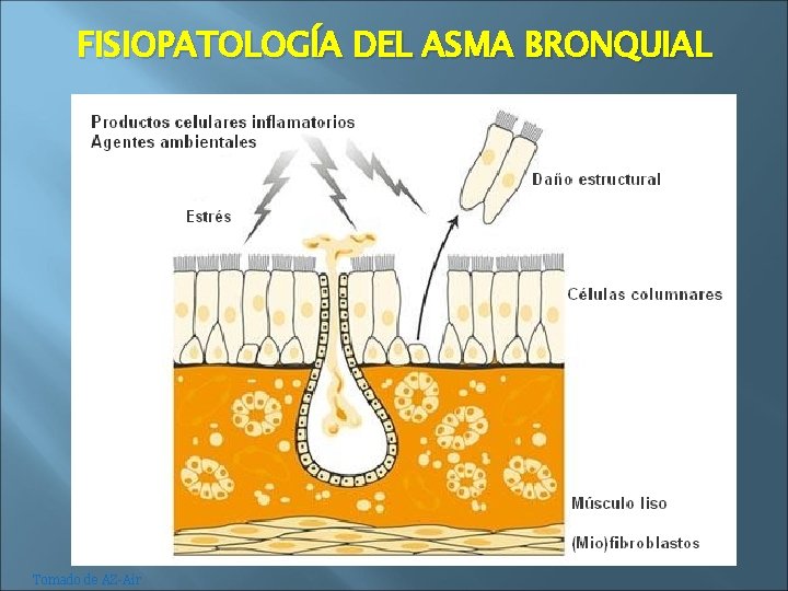 FISIOPATOLOGÍA DEL ASMA BRONQUIAL Tomado de AZ-Air 