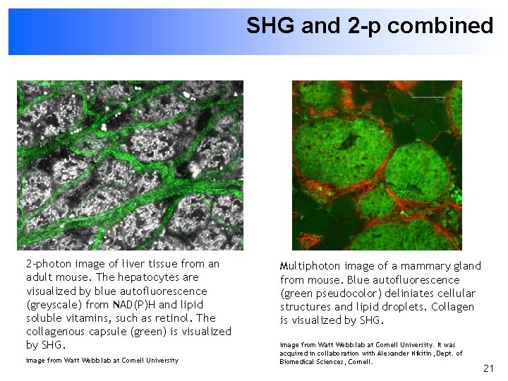 SHG and 2 -p combined 2 -photon image of liver tissue from an adult