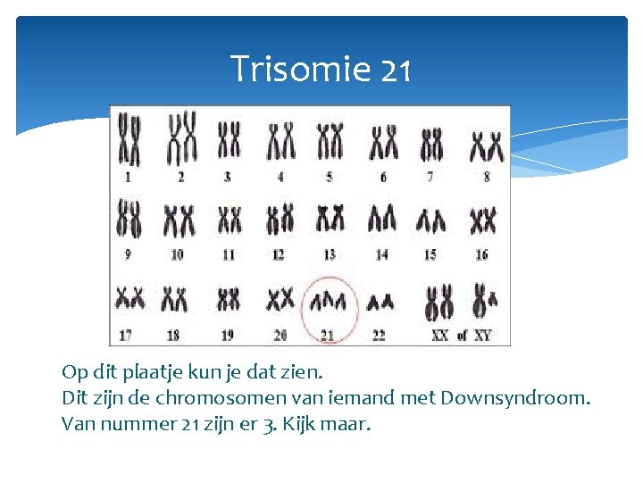 Trisomie 21 Op dit plaatje kun je dat zien. Dit zijn de chromosomen van