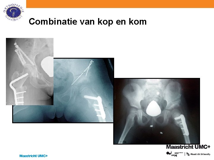 Combinatie van kop en kom 