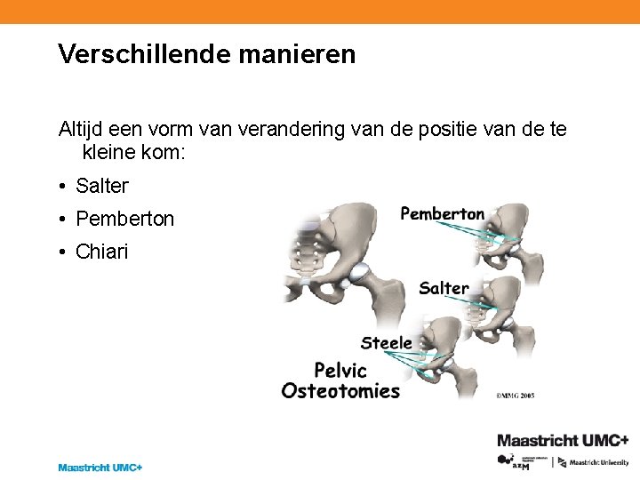 Verschillende manieren Altijd een vorm van verandering van de positie van de te kleine