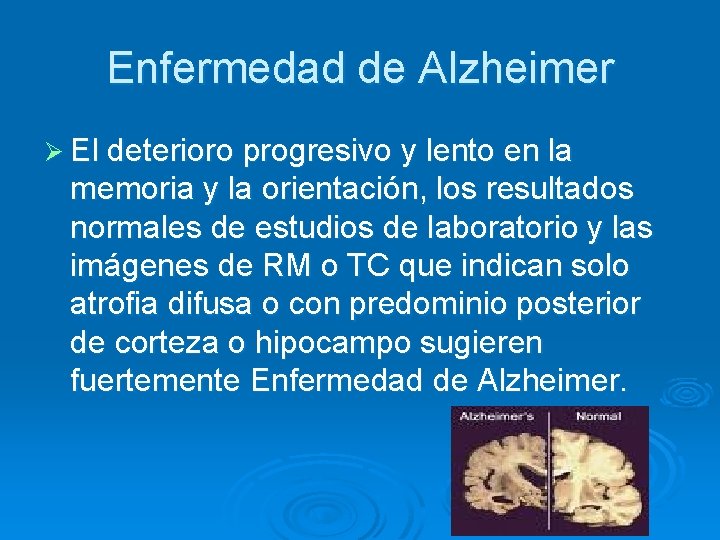 Enfermedad de Alzheimer Ø El deterioro progresivo y lento en la memoria y la