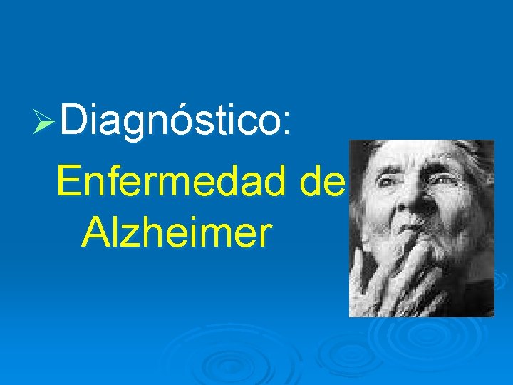 ØDiagnóstico: Enfermedad de Alzheimer 