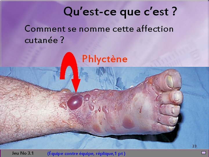 Qu’est-ce que c’est ? Comment se nomme cette affection cutanée ? Phlyctène 23 Jeu
