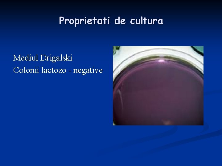 Proprietati de cultura Mediul Drigalski Colonii lactozo - negative 