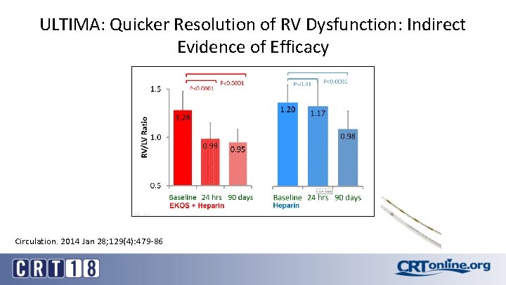 ULTIMA: Quicker Resolution of RV Dysfunction: Indirect Evidence of Efficacy Circulation. 2014 Jan 28;