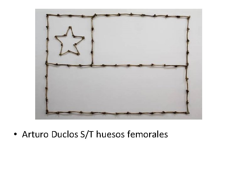  • Arturo Duclos S/T huesos femorales 