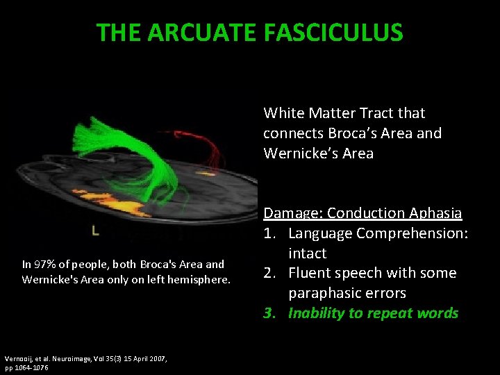 THE ARCUATE FASCICULUS White Matter Tract that connects Broca’s Area and Wernicke’s Area In