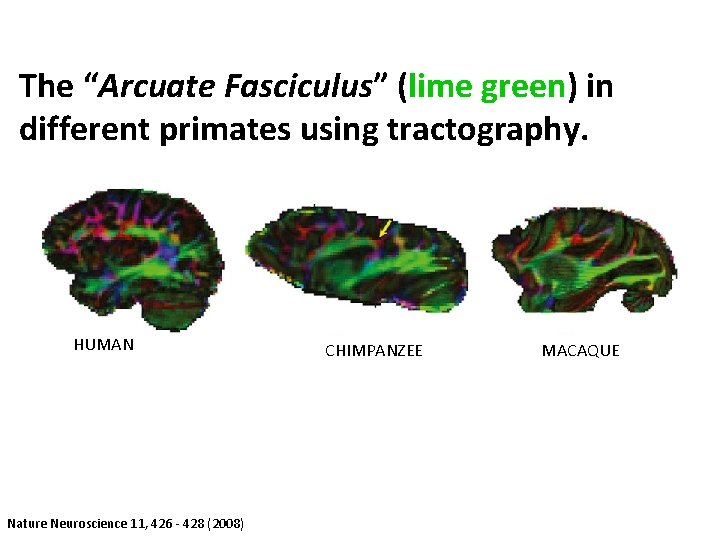The “Arcuate Fasciculus” (lime green) in different primates using tractography. HUMAN Nature Neuroscience 11,
