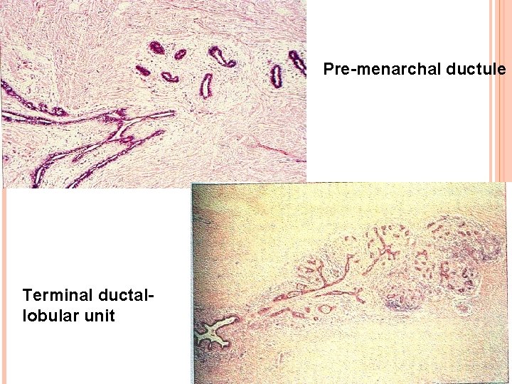 Pre-menarchal ductule Terminal ductallobular unit 