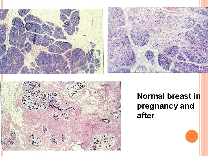 Normal breast in pregnancy and after 