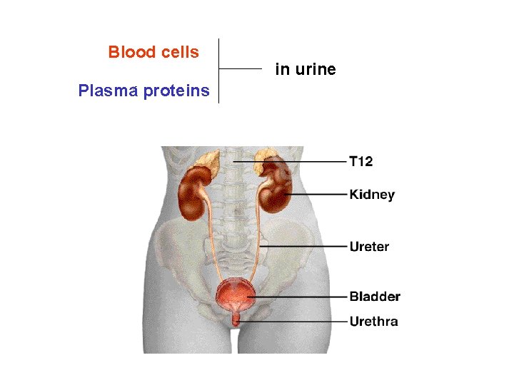 Blood cells Plasma proteins in urine Blood cells Plasma proteins in urine