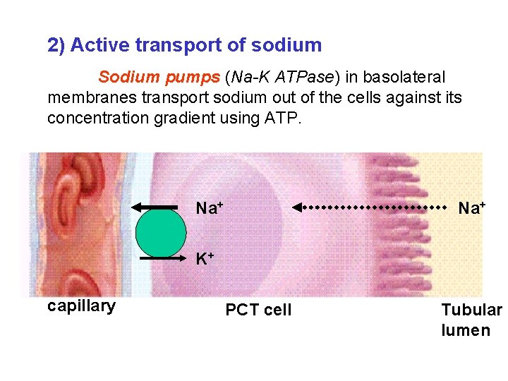 2) Active transport of sodium Sodium pumps (Na-K ATPase) in basolateral membranes transport sodium 2) Active transport of sodium Sodium pumps (Na-K ATPase) in basolateral membranes transport sodium