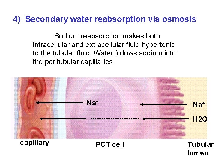 4) Secondary water reabsorption via osmosis Sodium reabsorption makes both intracellular and extracellular fluid 4) Secondary water reabsorption via osmosis Sodium reabsorption makes both intracellular and extracellular fluid