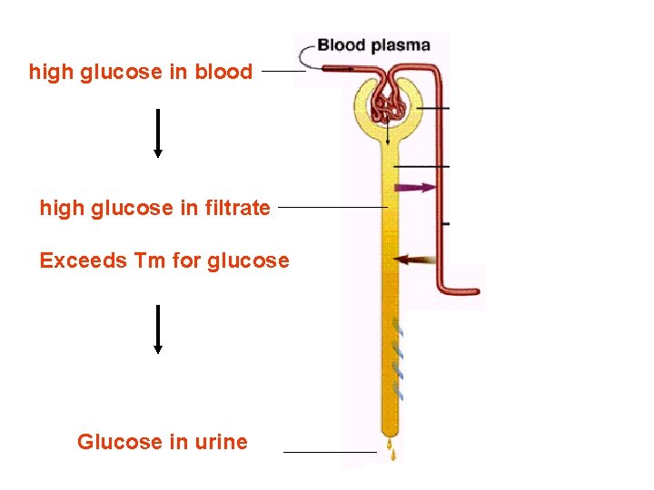 high glucose in blood high glucose in filtrate Exceeds Tm for glucose Glucose in high glucose in blood high glucose in filtrate Exceeds Tm for glucose Glucose in