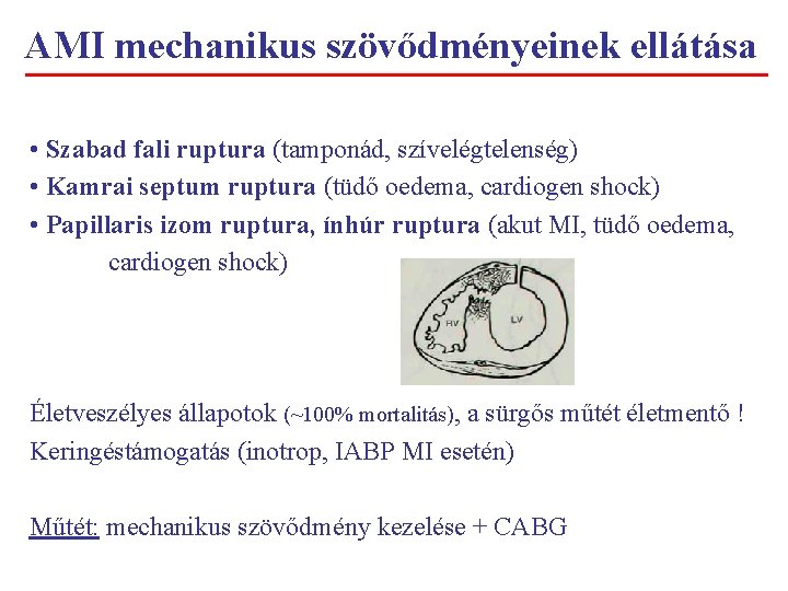 AMI mechanikus szövődményeinek ellátása • Szabad fali ruptura (tamponád, szívelégtelenség) • Kamrai septum ruptura