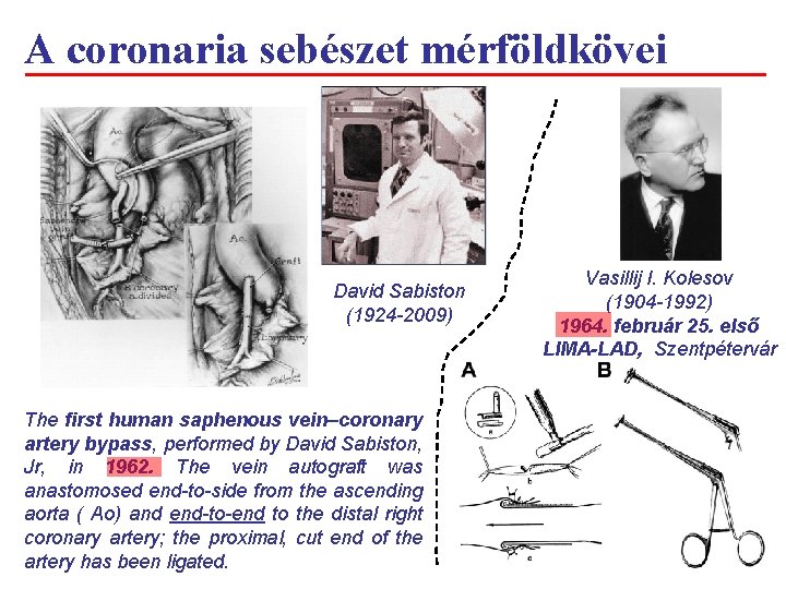 A coronaria sebészet mérföldkövei David Sabiston (1924 -2009) The first human saphenous vein–coronary artery