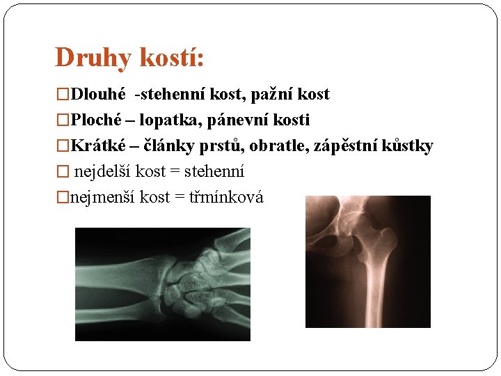 Druhy kostí: �Dlouhé -stehenní kost, pažní kost �Ploché – lopatka, pánevní kosti �Krátké –