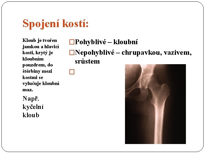 Spojení kostí: Kloub je tvořen jamkou a hlavicí kosti, krytý je kloubním pouzdrem, do