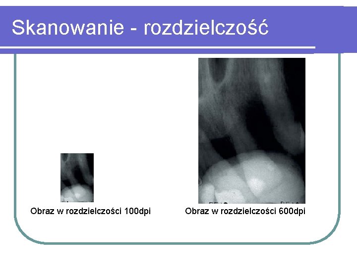 Skanowanie - rozdzielczość Obraz w rozdzielczości 100 dpi Obraz w rozdzielczości 600 dpi 