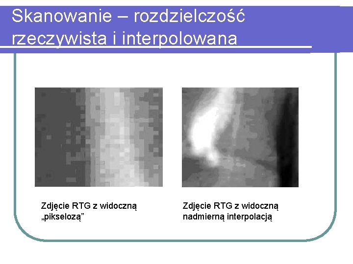 Skanowanie – rozdzielczość rzeczywista i interpolowana Zdjęcie RTG z widoczną „pikselozą” Zdjęcie RTG z