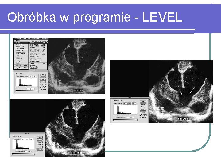 Obróbka w programie - LEVEL 