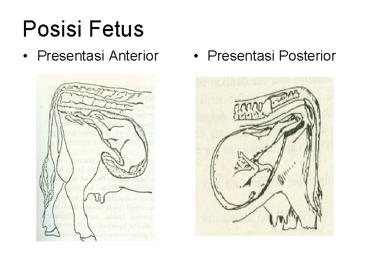 Posisi Fetus • Presentasi Anterior • Presentasi Posterior 