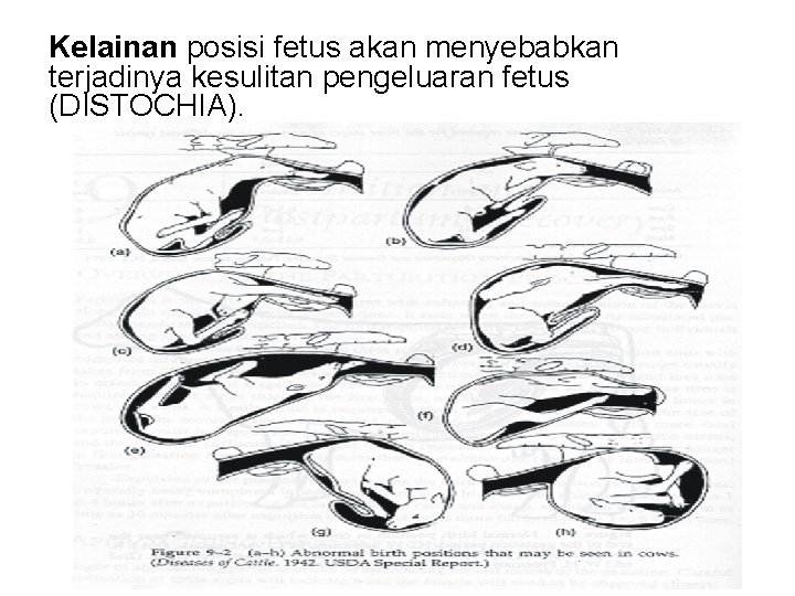 Kelainan posisi fetus akan menyebabkan terjadinya kesulitan pengeluaran fetus (DISTOCHIA). 