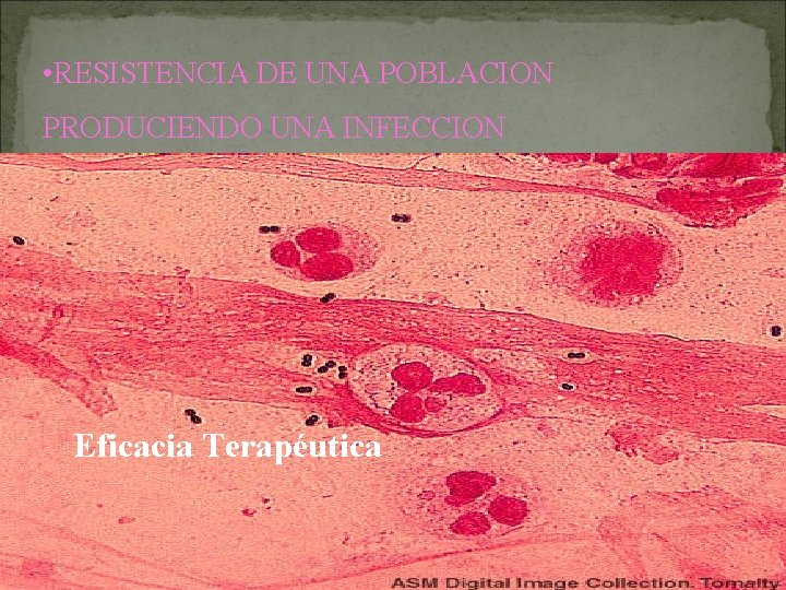  • RESISTENCIA DE UNA POBLACION PRODUCIENDO UNA INFECCION Eficacia Terapéutica 