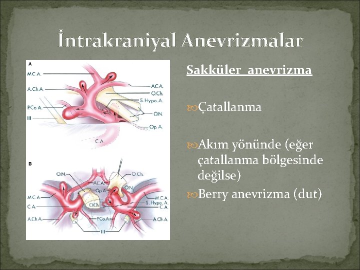 İntrakraniyal Anevrizmalar Sakküler anevrizma Çatallanma Akım yönünde (eğer çatallanma bölgesinde değilse) Berry anevrizma (dut)