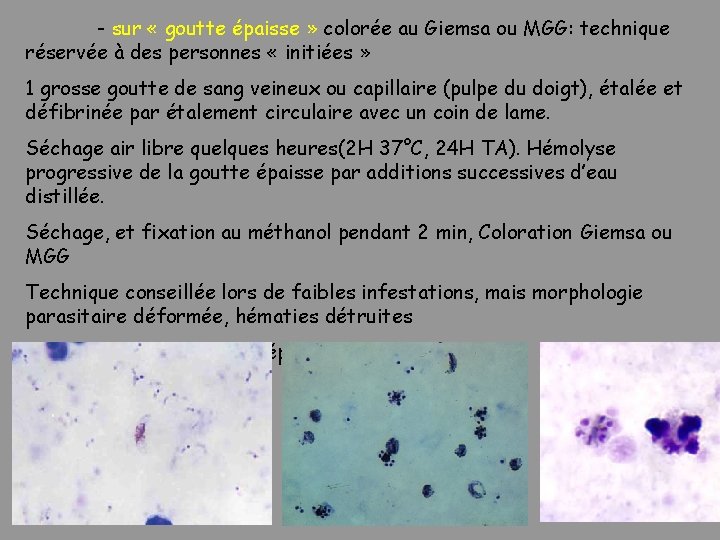- sur « goutte épaisse » colorée au Giemsa ou MGG: technique réservée à