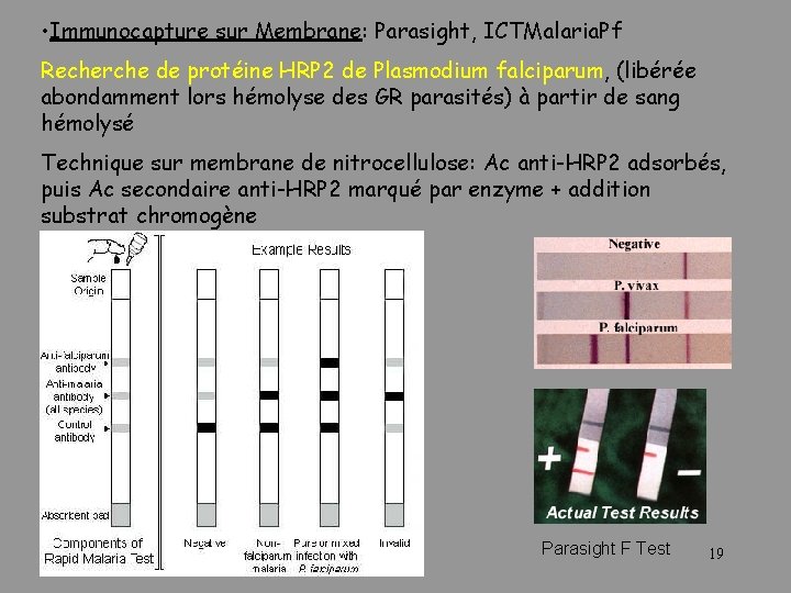  • Immunocapture sur Membrane: Parasight, ICTMalaria. Pf Recherche de protéine HRP 2 de