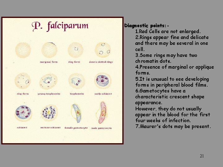 Diagnostic points: 1. Red Cells are not enlarged. 2. Rings appear fine and delicate