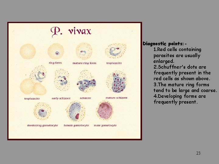  Diagnostic points: - 1. Red cells containing parasites are usually enlarged. 2. Schuffner's